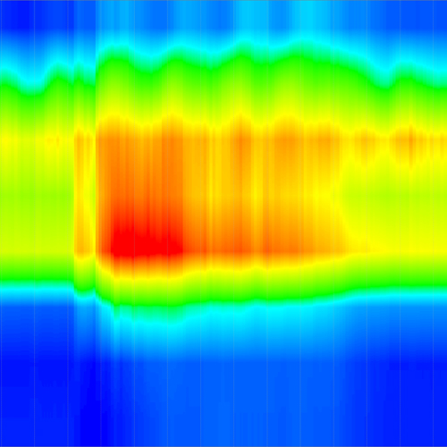 High Resolution Anorectal Manometry