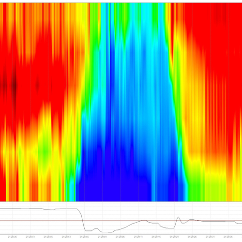 Impedance / pH metry